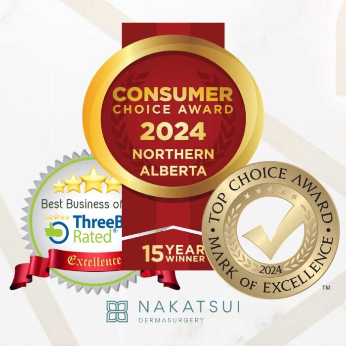 consumer choice award top choice best rated hair transplant edmonton