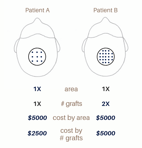 diagram of hair transplant cost and density