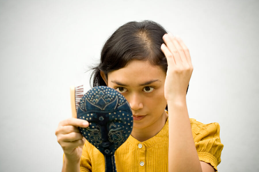 low testosterone female hair loss