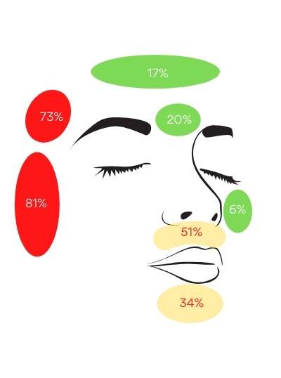 percentage of patients affected by increased hair growth from oral minoxidil