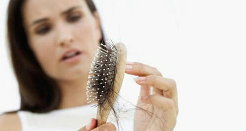 female pattern hair loss